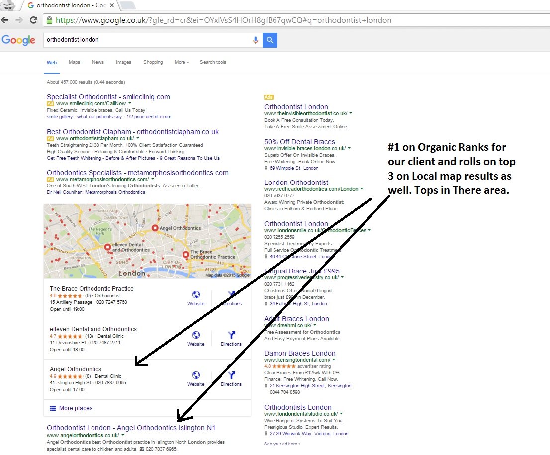 Best Orthodontics SEO Sevrices