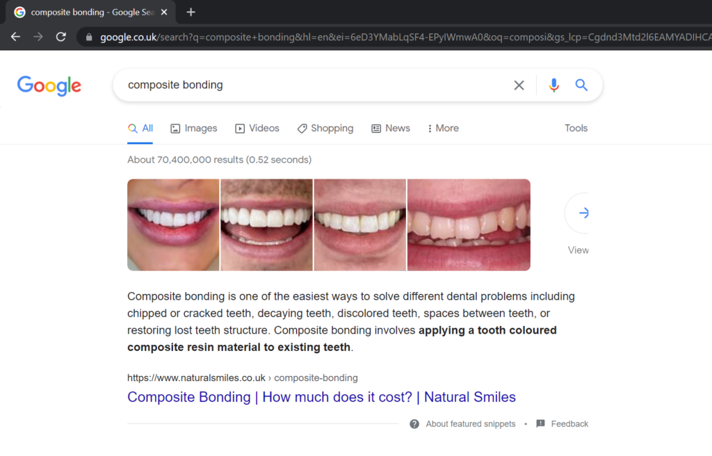 natural smiles ranking #1