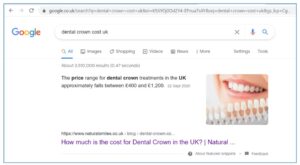 dental crown cost uk