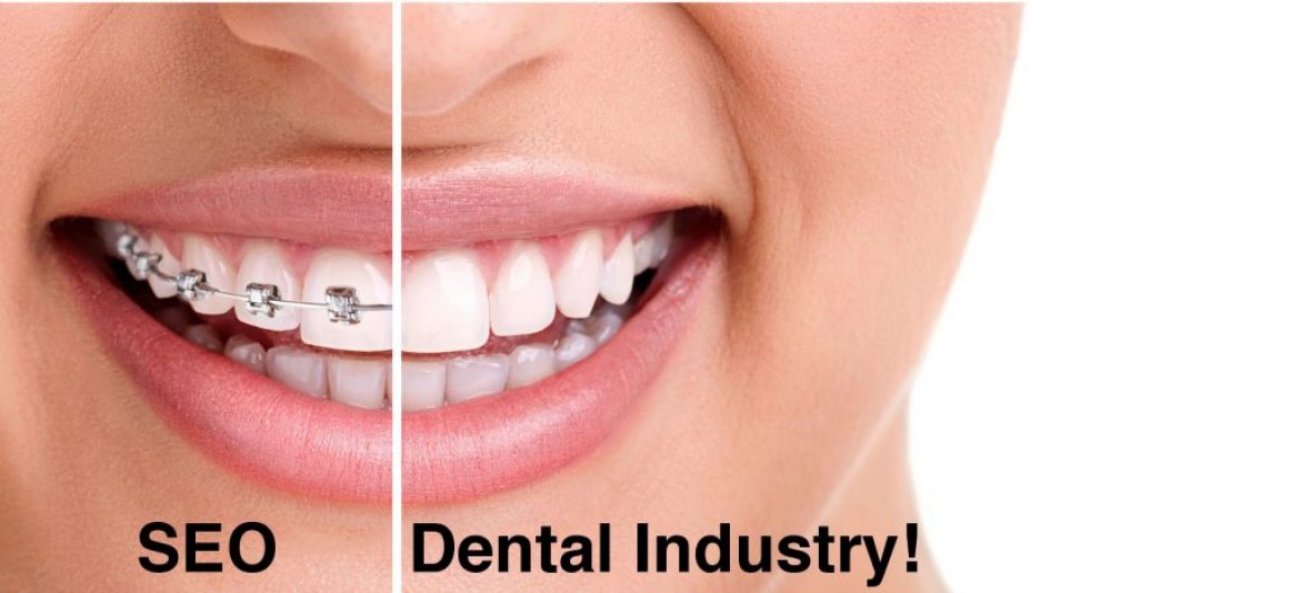 Why ClickDo is best in UK for dental Orthodontic SEO services in 2017?